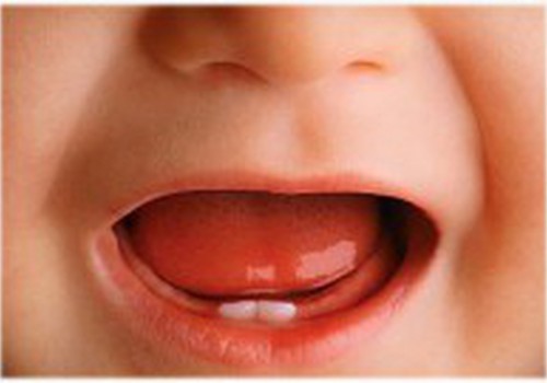 ОПРОС: Таблетки Dentokind помогают во время прорезывания зубов