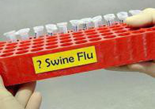 Зарегистрировано два случая заболевания гриппом