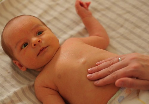 Колики у новорожденного - почему и как помочь?