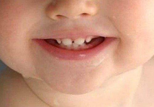 Всё, что тебе нужно знать о первых зубках