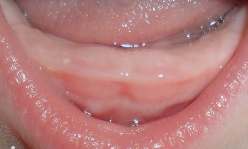 Зубыыыы и этим все сказано