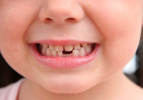 8 трюков, которые мотивируют детей чистить зубы