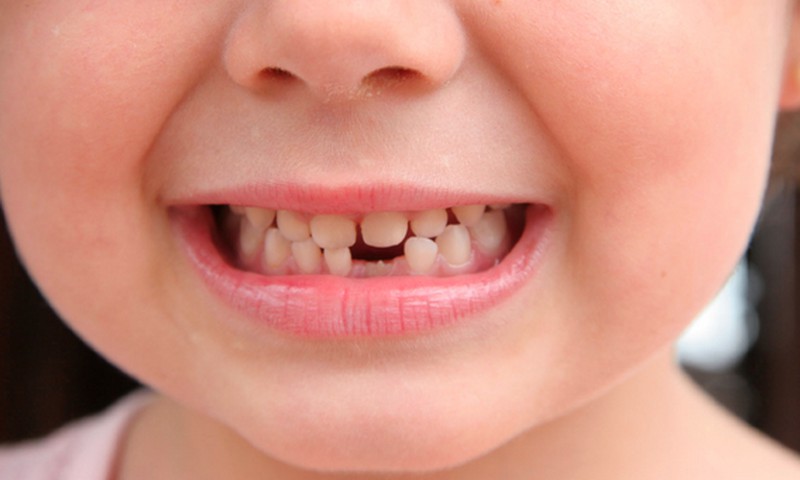 8 трюков, которые мотивируют детей чистить зубы