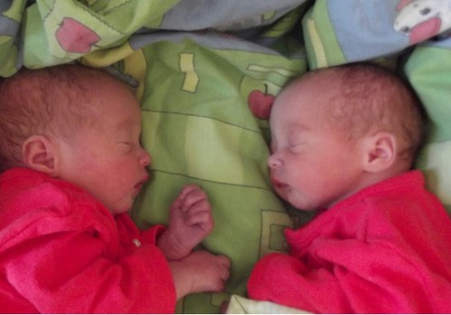 ЭКСКЛЮЗИВ Māmiņu Klubs: Фотографии двойняшек, которые родились 13 июля