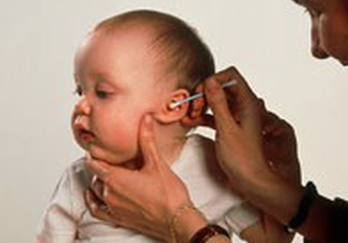 Чистить уши малышу или нет?