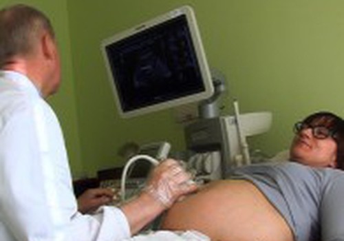 ВИДЕО: Выбираем гинеколога для будущей мамочки