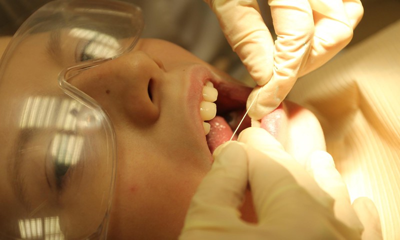 ОПРОС: 92% детей используют соответствующие возрасту зубные пасты