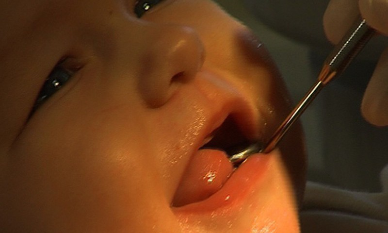 Как часто ребенка нужно показывать зубному?