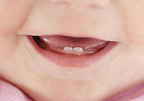  До какого возраста должны вылезти все зубки?